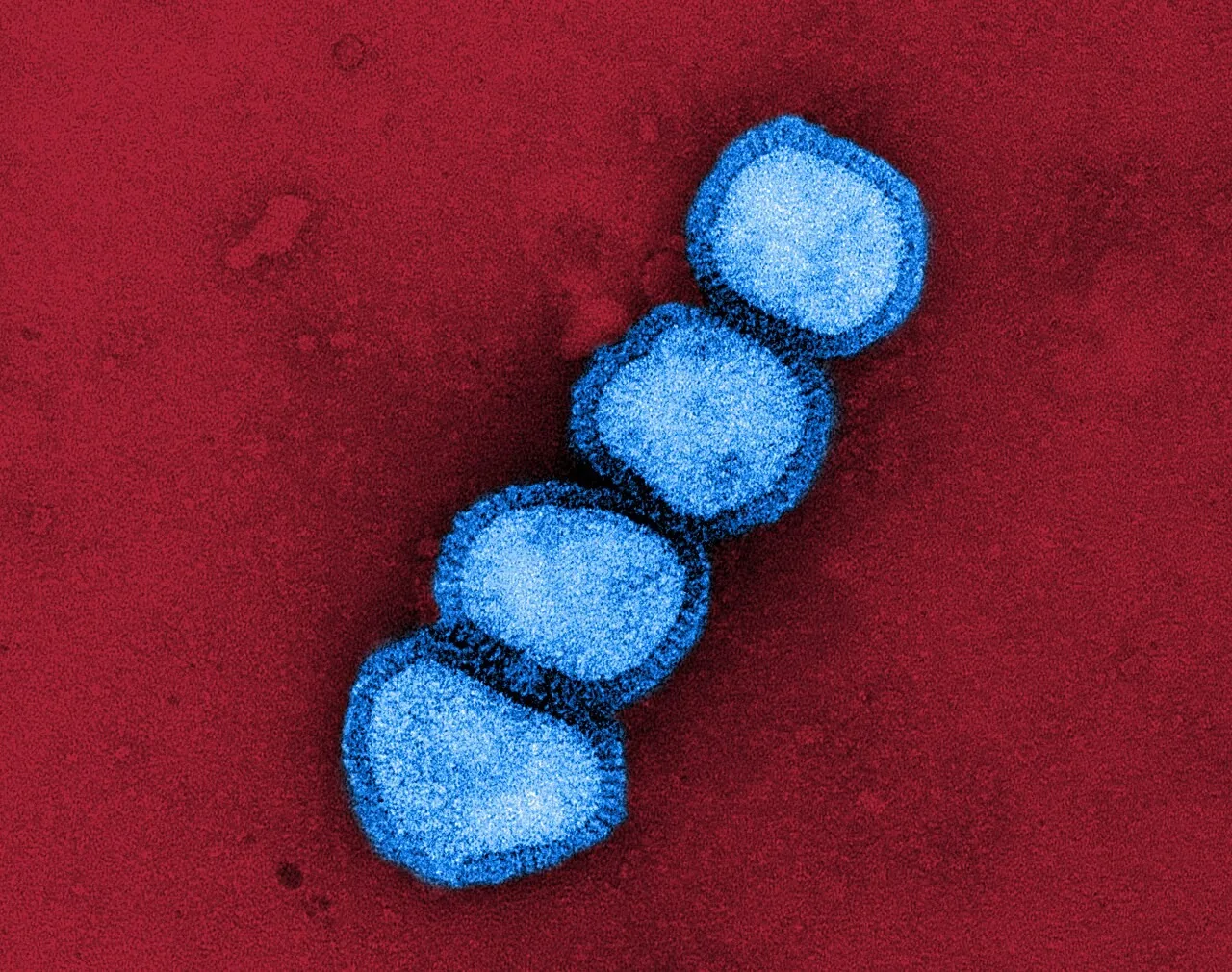푸른색을 입힌 인플루엔자 A/H1N1 바이러스 입자의 투과전자현미경 사진