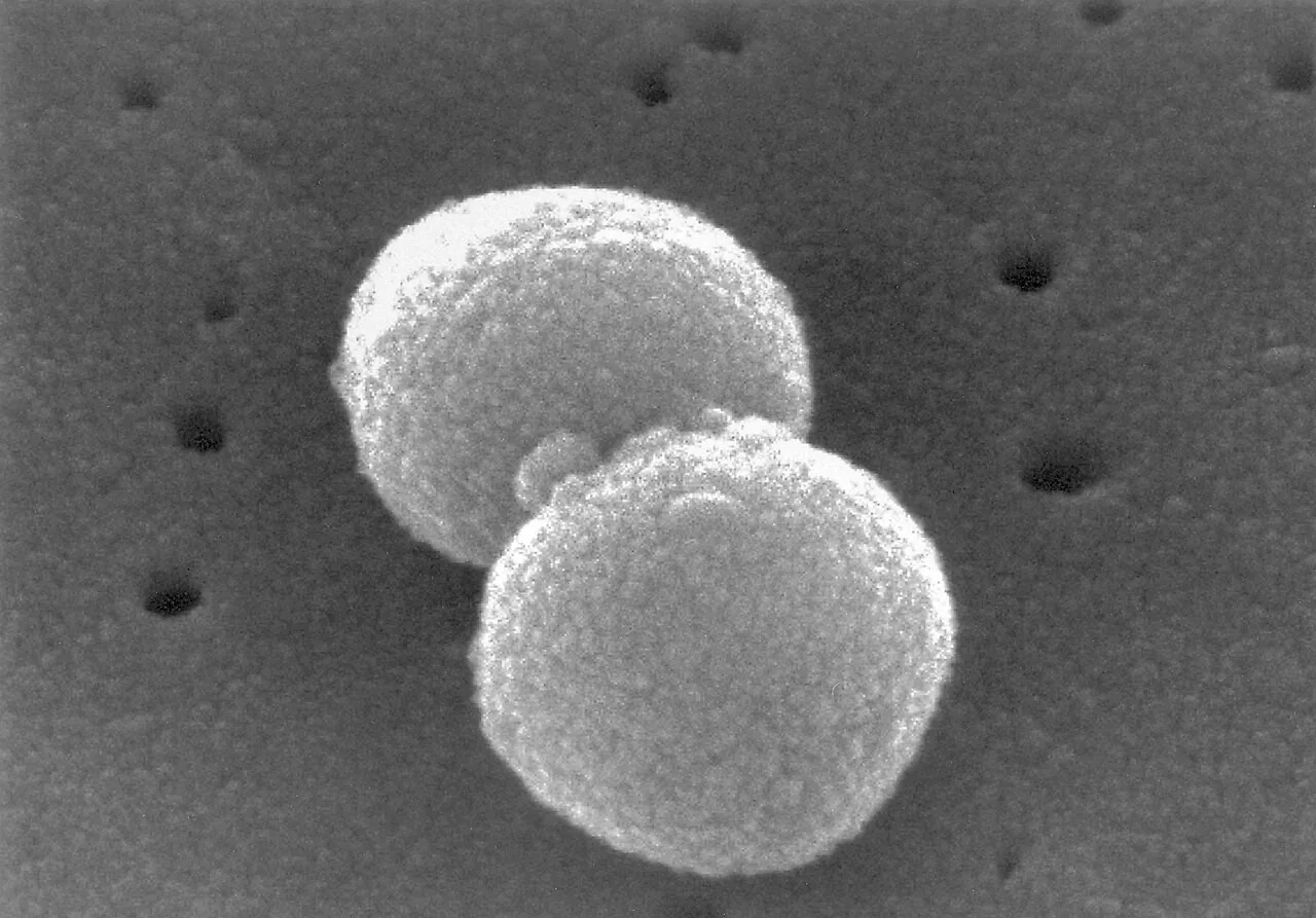 폐렴구균(Streptococcus pneumoniae) 쌍구균의 주사전자현미경 사진
